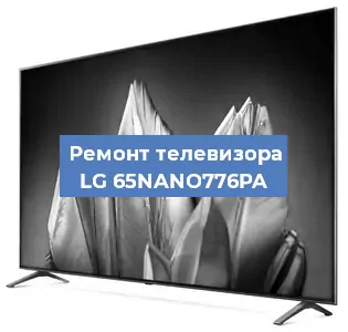 Замена светодиодной подсветки на телевизоре LG 65NANO776PA в Нижнем Новгороде